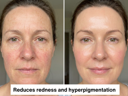 Dream Face Serum